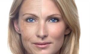Ringiovanimento del viso: prima e dopo