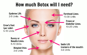 how-much-botox-will-i-need
